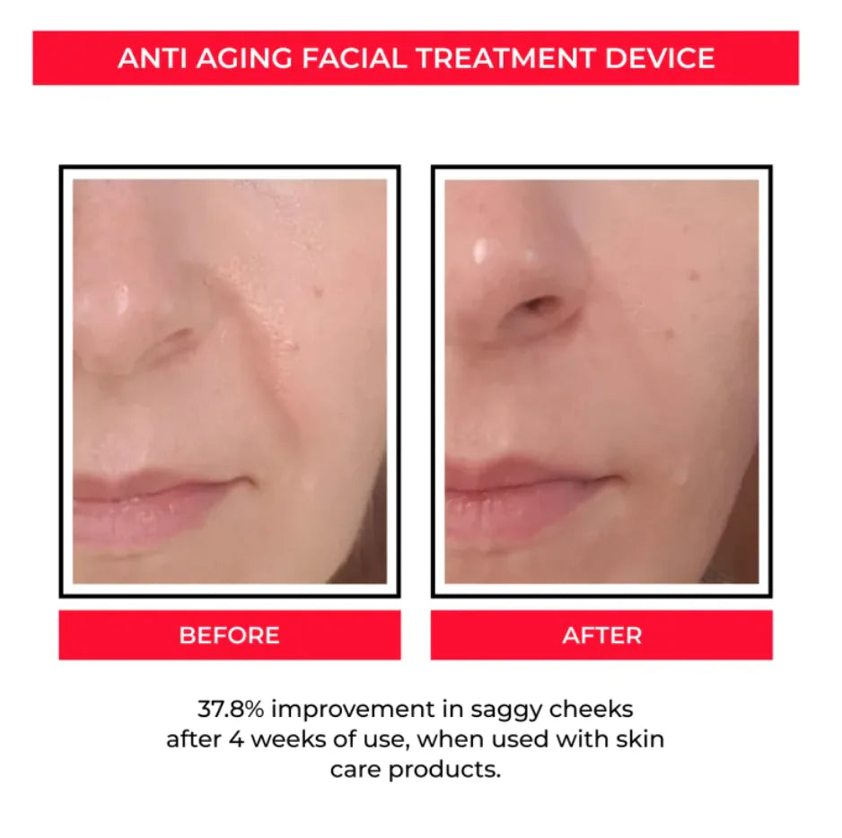 Microcurrent Facial Toning Tool