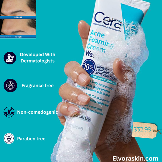CeraVe Acne Foaming Cream Wash Gentle Face and Body Cleanser with Benzoyl Peroxide 10% Hyaluronic Acid and Niacinamide 10% Benzoyl Peroxide Treatment Clears Pimples and Blackheads 5 Oz