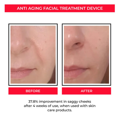 Microcurrent Facial Toning Tool