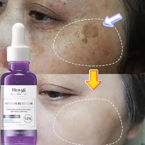 Youthful Glow Brightening Serum _ Anti-Aging Formula